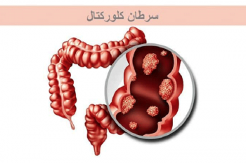 اجرای طرح «مطالعه تأثیر متامفتامین بر ژن‌های دخیل در سرطان کلورکتال» در فارس